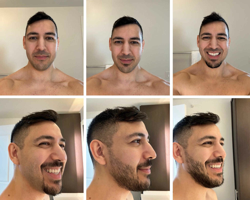 different facial hair styles